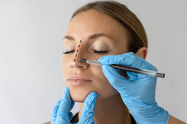 Rhinoplastie