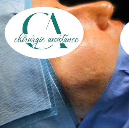 Avant rhinoplastie, vue de profil